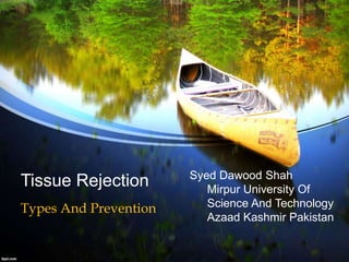 Tissue Rejection
Types And Prevention
Syed Dawood Shah
Mirpur University Of
Science And Technology
Azaad Kashmir Pakistan
 
