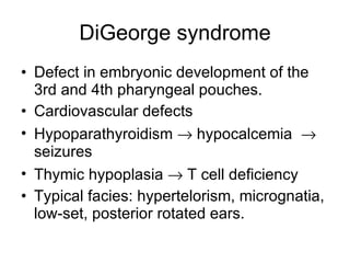 DiGeorge syndrome Defect in embryonic development of the 3rd and 4th pharyngeal pouches. Cardiovascular defects Hypoparathyroidism    hypocalcemia    seizures  Thymic hypoplasia    T cell def i ciency Typical facies: hypertelorism, micrognatia,  low-set, posterior rotated ears. 