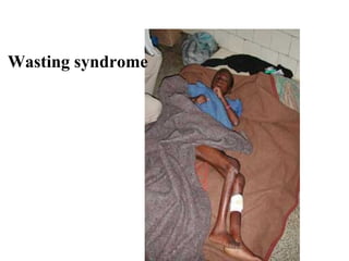 Wasting syndrome 