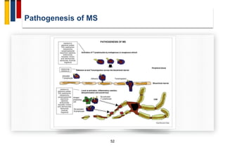 Immunopathogenesis of multiple sclerosis | PDF