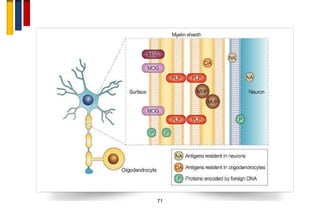 Immunopathogenesis of multiple sclerosis | PDF