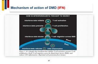 Immunopathogenesis of multiple sclerosis | PDF
