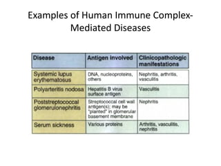 Examples of Human Immune Complex-
Mediated Diseases
 