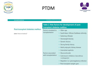 PTDM
 
