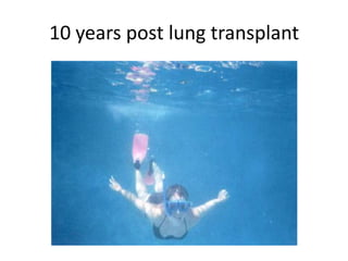 10 years post lung transplant
 