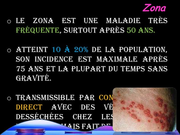De pour quoi peuvent sortir les boutons sur la personne