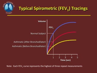 Typical Spirometric (FEV1) Tracings
1
Time (sec)
2 3 4 5
FEV1
Volume
Normal Subject
Asthmatic (After Bronchodilator)
Asthm...