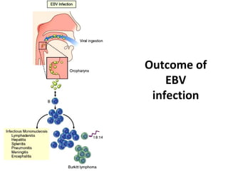 Outcome of
EBV
infection
 