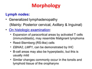 Morphology
Lymph nodes:
• Generalized lymphadenopathy
(Mainly: Posterior cervical, Axillary & Inguinal)
• On histologic examination:
• Expansion of paracortical areas by activated T cells
(immunoblasts), may resemble Malignant lymphoma
• Reed-Sternberg (RS-like) cells
• EBNA2, LMP1, can be demonstrated by IHC
• B-cell areas may also be hyperplastic, but this is
usually mild
• Similar changes commonly occur in the tonsils and
lymphoid tissue of the oropharynx
 