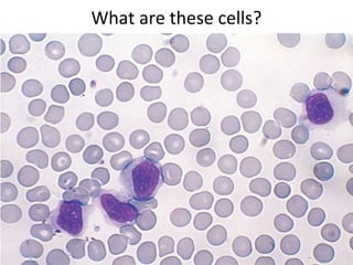 What are these cells?
 