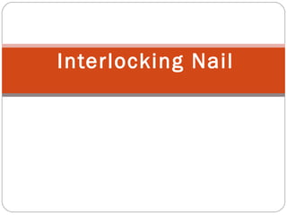 Interlocking Nail
 