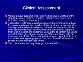 Clinical Assessment
Visible severe wasting. This is defined as severe wasting of the
shoulders, arms, buttocks, and legs, with ribs easily seen, and
indicates presence of marasmus.
To look for visible severe wasting, remove the child's clothes. Look
for severe wasting of the muscles of the shoulders, arms, buttocks
and legs. Look to see if the outline of the child's ribs is easily seen.
Look at the child's hips. They may look small when you compare
them with the chest and abdomen. Look at the child from the side to
see if the fat of the buttocks is missing. When wasting is extreme,
there are many folds of skin on the buttocks and thigh. It looks as if
the child is wearing baggy pants. The face of a child with visible
severe wasting may still look normal.
The child's abdomen may be large or distended.
 