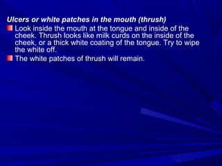 Ulcers or white patches in the mouth (thrush)
Look inside the mouth at the tongue and inside of the
cheek. Thrush looks like milk curds on the inside of the
cheek, or a thick white coating of the tongue. Try to wipe
the white off.
The white patches of thrush will remain.
 
