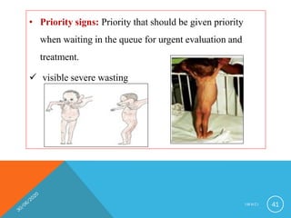 • Priority signs: Priority that should be given priority
when waiting in the queue for urgent evaluation and
treatment.
 visible severe wasting
I M N C I 41
 