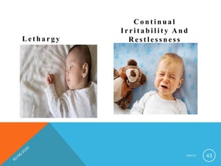 L e t h a r g y
C o n t i n u a l
I r r i t a b i l i t y A n d
R e s t l e s s n e s s
I M N C I 43
 