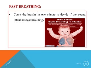 • Count the breaths in one minute to decide if the young
infant has fast breathing.
FAST BREATHING:
I M N C I 70
 