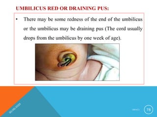 • There may be some redness of the end of the umbilicus
or the umbilicus may be draining pus (The cord usually
drops from the umbilicus by one week of age).
UMBILICUS RED OR DRAINING PUS:
I M N C I 78
 