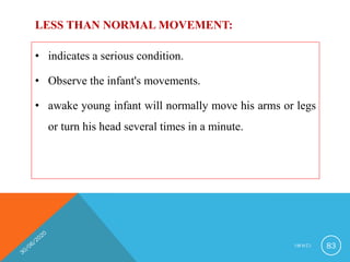 LESS THAN NORMAL MOVEMENT:
• indicates a serious condition.
• Observe the infant's movements.
• awake young infant will normally move his arms or legs
or turn his head several times in a minute.
I M N C I 83
 
