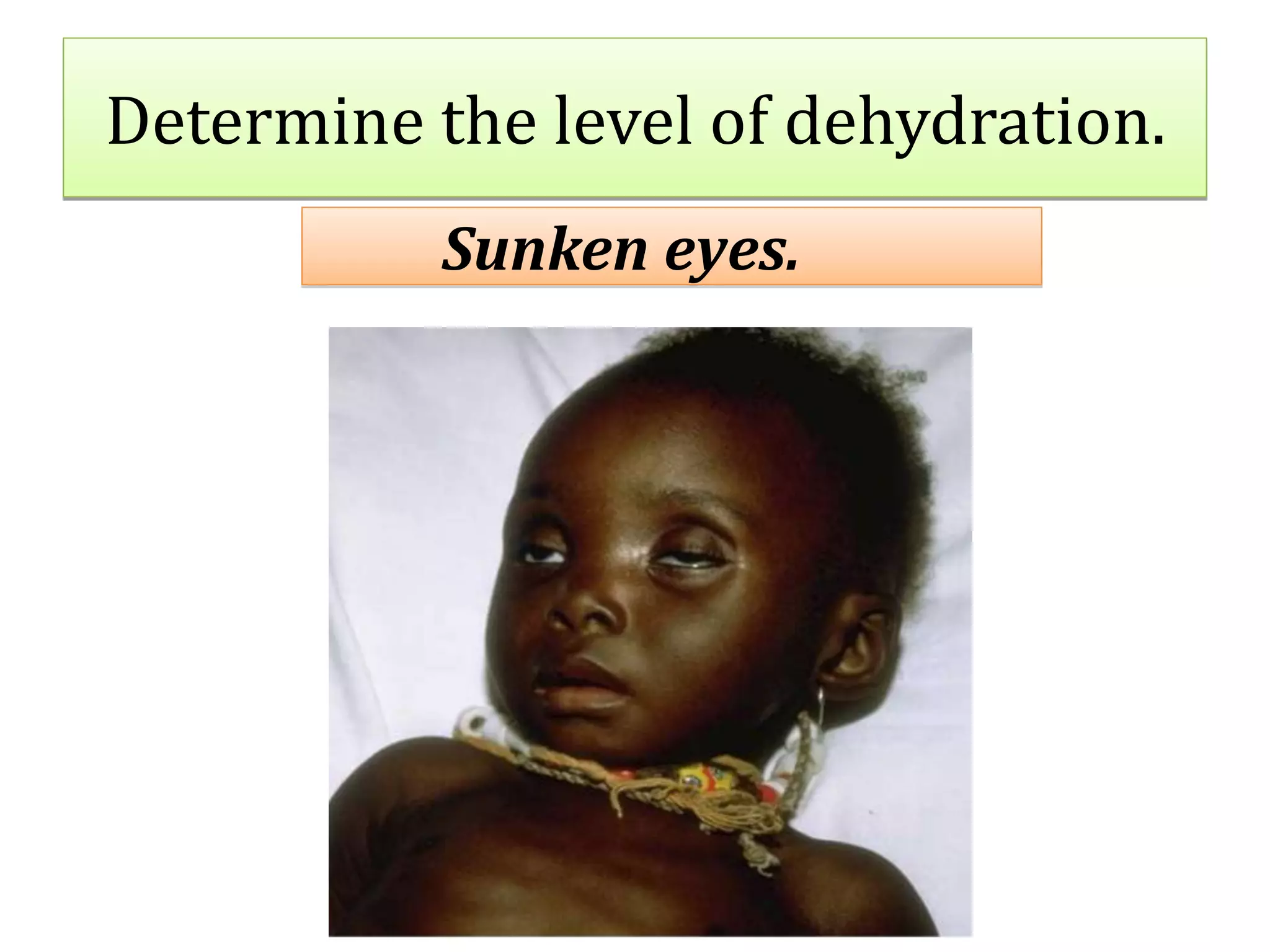 IMNCI Diarrhoea PPTX imnci-diarrhoea-pptx