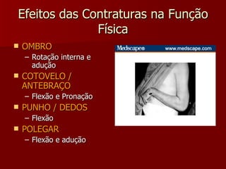 Efeitos das Contraturas na Função Física OMBRO Rotação interna e adução COTOVELO / ANTEBRAÇO Flexão e Pronação PUNHO / DEDOS Flexão POLEGAR Flexão e adução 