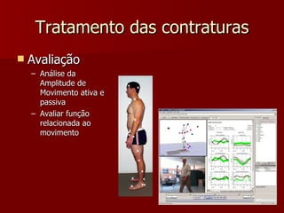 Tratamento das contraturas Avaliação Análise da Amplitude de Movimento ativa e passiva Avaliar função relacionada ao movimento 