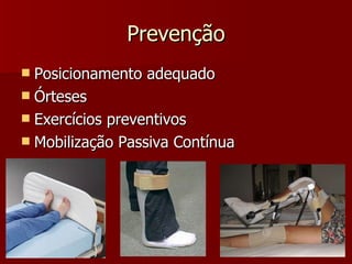 Prevenção Posicionamento adequado Órteses Exercícios preventivos Mobilização Passiva Contínua 