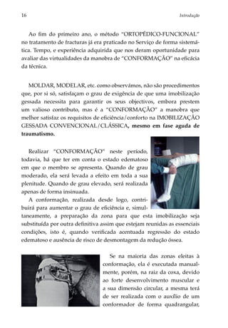 16	                                                             Introdução



   Ao fim do primeiro ano, o método “ORTOPÉDICO-FUNCIONAL”
no tratamento de fracturas já era praticado no Serviço de forma sistemá­
tica. Tempo, e experiência adquirida que nos deram oportunidade para
avaliar das virtualidades da manobra de “CONFORMAÇÃO” na eficácia
da técnica.


   MOLDAR, MODELAR, etc. como observámos, não são procedimentos
que, por si só, satisfaçam o grau de exigência de que uma imobilização
gessada necessita para garantir os seus objectivos, embora prestem
um valioso contributo, mas é a “CONFORMAÇÃO” a manobra que
melhor satisfaz os requisitos de eficiência/conforto na IMOBILIZAÇÃO
GESSADA CONVENCIONAL/CLÁSSICA, mesmo em fase aguda de
traumatismo.


   Realizar “CONFORMAÇÃO” neste período,
todavia, há que ter em conta o estado edematoso
em que o membro se apresenta. Quando de grau
moderado, ela será levada a efeito em toda a sua
plenitude. Quando de grau elevado, será realizada
apenas de forma insinuada.
   A conformação, realizada desde logo, contri­
buirá para aumentar o grau de eficiência e, simul­
taneamente, a preparação da zona para que esta imobilização seja
substituída por outra definitiva assim que estejam reunidas as essenciais
condições, isto é, quando verificada acentuada regressão do estado
edematoso e ausência de risco de desmontagem da redução óssea.

                                    Se na maioria das zonas eleitas à
                                 conformação, ela é executada manual­
                                 mente, porém, na raiz da coxa, devido
                                 ao forte desenvolvimento muscular e
                                 a sua dimensão circular, a mesma terá
                                 de ser realizada com o auxílio de um
                                 conformador de forma quadrangular,
 