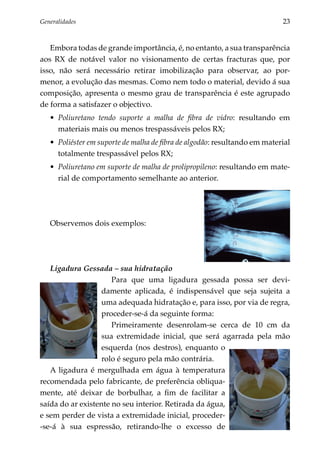 Generalidades	                                                              23


   Embora todas de grande importância, é, no entanto, a sua transparência
aos RX de notável valor no visionamento de certas fracturas que, por
isso, não será necessário retirar imobilização para observar, ao por­
menor, a evolução das mesmas. Como nem todo o material, devido á sua
composição, apresenta o mesmo grau de transparência é este agrupado
de forma a satisfazer o objectivo.
   •	 Poliuretano tendo suporte a malha de fibra de vidro: resultando em
      materiais mais ou menos trespassáveis pelos RX;
   •	 Poliéster em suporte de malha de fibra de algodão: resultando em material
      total­ ente trespassável pelos RX;
           m
   •	 Poliuretano em suporte de malha de prolipropileno: resultando em mate­
      rial de comportamento semelhante ao anterior.




   Observemos dois exemplos:




   Ligadura Gessada – sua hidratação
                      Para que uma ligadura gessada possa ser devi­
                   damente aplicada, é indispensável que seja sujeita a
                   uma adequada hidratação e, para isso, por via de regra,
                   proceder-se-á da seguinte forma:
                      Primeiramente desenrolam-se cerca de 10 cm da
                   sua extremidade inicial, que será agarrada pela mão
                   esquerda (nos destros), enquanto o
                   rolo é seguro pela mão contrária.
   A ligadura é mergulhada em água à temperatura
recomendada pelo fabricante, de preferência obliqua­
mente, até deixar de borbulhar, a fim de facilitar a
saída do ar existente no seu interior. Retirada da água,
e sem perder de vista a extremidade inicial, proceder­
‑se-á à sua espressão, retirando-lhe o excesso de
 