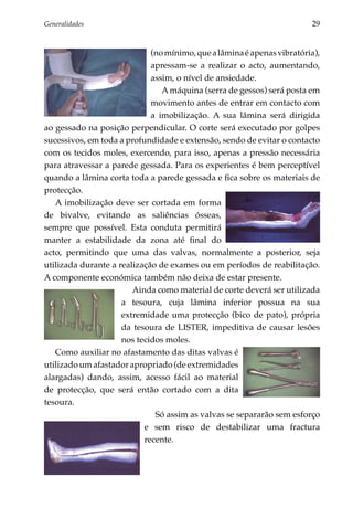 Generalidades	                                                          29


                             (no mínimo, que a lâmina é apenas vibratória),
                             apressam-se a realizar o acto, aumentando,
                             assim, o nível de ansiedade.
                                A máquina (serra de gessos) será posta em
                             movimento antes de entrar em contacto com
                             a imobilização. A sua lâmina será dirigida
ao gessado na posição perpendicular. O corte será executado por golpes
sucessivos, em toda a profundidade e extensão, sendo de evitar o contacto
com os tecidos moles, exercendo, para isso, apenas a pressão necessária
para atravessar a parede gessada. Para os experientes é bem perceptível
quando a lâmina corta toda a parede gessada e fica sobre os materiais de
protecção.
   A imobilização deve ser cortada em forma
de bivalve, evitando as saliências ósseas,
sempre que possível. Esta conduta permitirá
manter a estabilidade da zona até final do
acto, permitindo que uma das valvas, normalmente a posterior, seja
utilizada durante a realização de exames ou em períodos de reabilitação.
A componente económica também não deixa de estar presente.
                        Ainda como material de corte deverá ser utilizada
                     a tesoura, cuja lâmina inferior possua na sua
                     extremidade uma protecção (bico de pato), própria
                     da tesoura de LISTER, impeditiva de causar lesões
                     nos tecidos moles.
   Como auxiliar no afastamento das ditas valvas é
utilizado um afastador apropriado (de extremidades
alargadas) dando, assim, acesso fácil ao material
de protecção, que será então cortado com a dita
tesoura.
                              Só assim as valvas se separarão sem esforço
                           e sem risco de destabilizar uma fractura
                           recente.
 