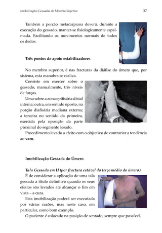 Imobilizações Gessadas do Membro Superior	                             37


   Também a porção metacarpiana deverá, durante a
execução do gessado, manter-se fisiologicamente espal­
mada. Facilitando os movimentos normais de todos
os dedos.



   Três pontos de apoio estabilizadores

   No membro superior, é nas fracturas da diáfise do úmero que, por
sistema, esta manobra se realiza.
   Consiste em exercer sobre o
gessado, manualmente, três níveis
de forças.
   Uma sobre a zona epifisária distal
interna; outra, em sentido oposto, na
porção diafisária mediana externa;
a terceira no sentido da primeira,
exercida pela oposição da parte
proximal do segmento lesado.
   Procedimento levado a efeito com o objectivo de contrariar a tendência
ao varo.




   Imobilização Gessada do Úmero

   Tala Gessada em U (por fractura estável do terço médio do úmero)
   É de considerar a aplicação de uma tala
gessada a título definitivo quando os seus
efeitos são leva­ os até alcançar o fim em
                d
vista – a cura.
   Esta imobilização poderá ser executada
por várias razões, mas neste caso, em
particular, como bom exemplo.
   O paciente é colocado na posição de sentado, sempre que possível.
 