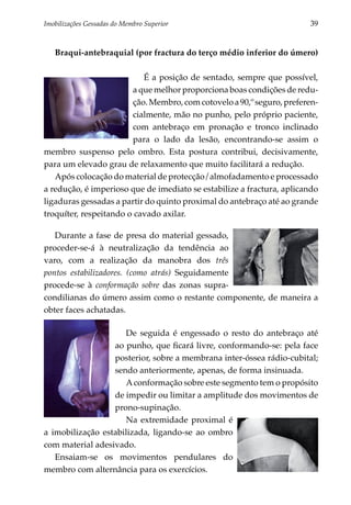 Imobilizações Gessadas do Membro Superior	                              39


   Braqui-antebraquial (por fractura do terço médio inferior do úmero)

                           É a posição de sentado, sempre que possível,
                        a que melhor proporciona boas condições de redu­
                        ção. Membro, com cotovelo a 90,º seguro, prefe­ en­
                                                                       r
                        cialmente, mão no punho, pelo próprio paciente,
                        com antebraço em pronação e tronco inclinado
                        para o lado da lesão, encontrando-se assim o
membro suspenso pelo ombro. Esta postura contribui, decisivamente,
para um elevado grau de relaxamento que muito facilitará a redução.
   Após colocação do material de protecção/almofadamento e processado
a redução, é imperioso que de imediato se estabilize a fractura, aplicando
ligaduras gessadas a partir do quinto proximal do antebraço até ao grande
troquíter, respeitando o cavado axilar.

   Durante a fase de presa do material gessado,
proceder-se-á à neutralização da tendência ao
varo, com a realização da manobra dos três
pontos estabilizadores. (como atrás) Seguidamente
procede-se à conformação sobre das zonas supra-
condilianas do úmero assim como o restante componente, de maneira a
obter faces achatadas.

                     De seguida é engessado o resto do antebraço até
                  ao punho, que ficará livre, conformando-se: pela face
                  posterior, sobre a membrana inter-óssea rádio-cubital;
                  sendo anteriormente, apenas, de forma insinuada.
                     A conformação sobre este segmento tem o propósito
                  de impedir ou limitar a amplitude dos movimentos de
                  prono-supinação.
                     Na extremidade proximal é
a imobilização estabilizada, ligando-se ao ombro
com material adesivado.
   Ensaiam-se os movimentos pendulares do
membro com alternância para os exercícios.
 