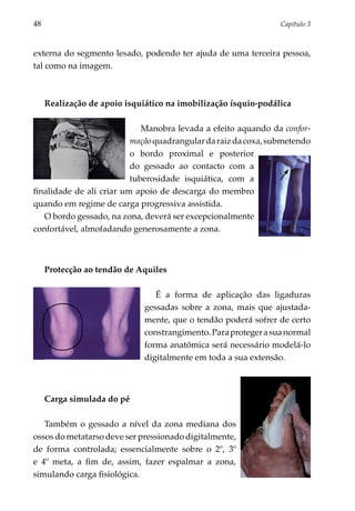 48	                                                               Capítulo 3



externa do segmento lesado, podendo ter ajuda de uma terceira pessoa,
tal como na imagem.



      Realização de apoio isquiático na imobilização ísquio-podálica

                             Manobra levada a efeito aquando da confor­
                          mação quadrangular da raiz da coxa, submetendo
                          o bordo proximal e posterior
                          do gessado ao contacto com a
                          tuberosidade isquiática, com a
finalidade de ali criar um apoio de descarga do membro
quando em regime de carga progressiva assistida.
   O bordo gessado, na zona, deverá ser excepcionalmente
confortável, almofadando generosamente a zona.



      Protecção ao tendão de Aquiles

                                  É a forma de aplicação das ligaduras
                               gessadas sobre a zona, mais que ajustada­
                               mente, que o tendão poderá sofrer de certo
                               constrangimento. Para proteger a sua normal
                               forma anatómica será necessário modelá-lo
                               digitalmente em toda a sua extensão.



      Carga simulada do pé

   Também o gessado a nível da zona mediana dos
ossos do metatarso deve ser pressionado digitalmente,
de forma controlada; essencialmente sobre o 2º, 3º
e 4º meta, a fim de, assim, fazer espalmar a zona,
simulando carga fisiológica.
 