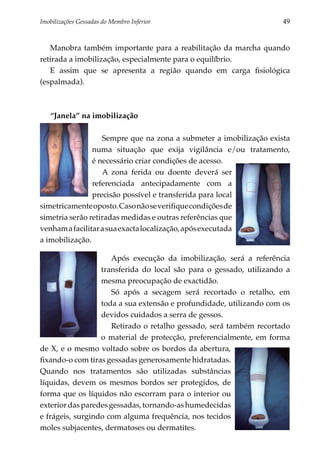 Imobilizações Gessadas do Membro Inferior 	                          49


   Manobra também importante para a reabilitação da marcha quando
retirada a imobilização, especialmente para o equilíbrio.
   E assim que se apresenta a região quando em carga fisiológica
(espalmada).



   “Janela” na imobilização

                   Sempre que na zona a submeter a imobilização exista
                numa situação que exija vigilância e/ou tratamento,
                é necessário criar condições de acesso.
                   A zona ferida ou doente deverá ser
                referenciada antecipadamente com a
                pre­ isão possível e transferida para local
                    c
simetricamente oposto. Caso não se verifique condições de
simetria serão retiradas medidas e outras referências que
venham a facilitar a sua exacta localização, após executada
a imobilização.

                      Após execução da imobilização, será a referência
                  transferida do local são para o gessado, utilizando a
                  mesma preocupação de exactidão.
                      Só após a secagem será recortado o retalho, em
                  toda a sua extensão e profundidade, utilizando com os
                  devidos cuidados a serra de gessos.
                      Retirado o retalho gessado, será também recortado
                  o material de protec­ ão, preferencial­ ente, em forma
                                        ç               m
de X, e o mesmo voltado sobre os bordos da abertura,
fixando-o com tiras gessadas generosamente hidratadas.
Quando nos tratamentos são utilizadas substâncias
líquidas, devem os mesmos bordos ser protegidos, de
forma que os líquidos não escorram para o interior ou
exterior das paredes gessadas, tornando-as humedecidas
e frágeis, surgindo com alguma frequência, nos tecidos
moles subjacentes, dermatoses ou dermatites.
 