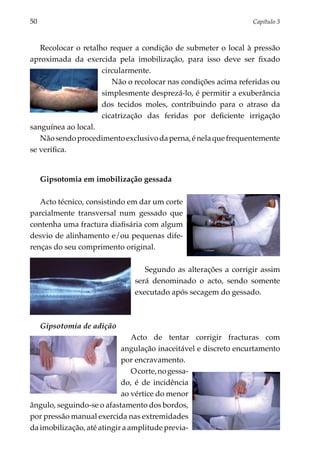 50	                                                               Capítulo 3



   Recolocar o retalho requer a condição de submeter o local à pressão
aproximada da exercida pela imobilização, para isso deve ser fixado
                     circularmente.
                        Não o recolocar nas condições acima referidas ou
                     simplesmente desprezá-lo, é permitir a exuberância
                     dos tecidos moles, contribuindo para o atraso da
                     cicatrização das feridas por deficiente irrigação
sanguínea ao local.
   Não sendo procedimento exclusivo da perna, é nela que frequentemente
se verifica.


      Gipsotomia em imobilização gessada

   Acto técnico, consistindo em dar um corte
parcialmente transversal num gessado que
contenha uma fractura diafisária com algum
desvio de alinhamento e/ou pequenas dife­
renças do seu comprimento original.

                                  Segundo as alterações a corrigir assim
                               será denominado o acto, sendo somente
                               executado após secagem do gessado.



      Gipsotomia de adição
                                  Acto de tentar corrigir fracturas com
                              angulação inaceitável e discreto encurtamento
                              por encravamento.
                                  O corte, no gessa­
                              do, é de incidência
                              ao vértice do menor
ângu­ o, seguindo-se o afastamento dos bordos,
     l
por pressão manual exercida nas extremidades
da imo­ i­ ização, até atingir a amplitude previa­
       bl
 