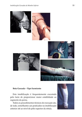 Imobilizações Gessadas do Membro Inferior 	           55




   Bota Gessada – Tipo Sarmiento

   Esta imobilização é frequentemente executada
pelo facto de proporcionar maior estabilidade ao
segmento da perna.
   Todos os procedimentos técnicos de execução são,
de todo, semelhantes aos praticados na imobilização
anterior até ao nível do pólo superior da rótula.
 