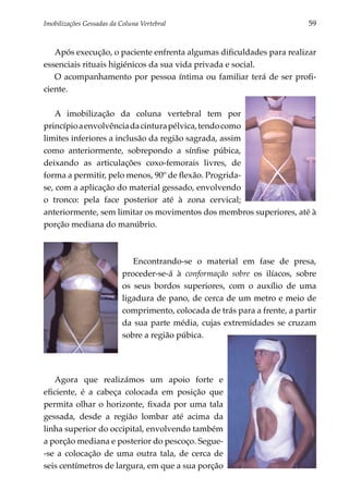 Imobilizações Gessadas da Coluna Vertebral	                                  59


   Após execução, o paciente enfrenta algumas dificuldades para realizar
essenciais rituais higiénicos da sua vida privada e social.
   O acompanhamento por pessoa íntima ou familiar terá de ser profi­
ciente.

    A imobilização da coluna vertebral tem por
princípio a envolvência da cintura pélvica, tendo como
limites inferiores a inclusão da região sagrada, assim
como anteriormente, sobrepondo a sínfise púbica,
deixando as articulações coxo-femorais livres, de
forma a permi­ ir, pelo menos, 90º de flexão. Progrida-
               t
se, com a aplicação do material gessado, envolvendo
o tronco: pela face posterior até à zona cervical;
anteriormente, sem limitar os movimentos dos membros superiores, até à
porção mediana do manúbrio.



                              Encontrando-se o material em fase de presa,
                           proceder-se-á à conformação sobre os ilíacos, sobre
                           os seus bordos superiores, com o auxílio de uma
                           ligadura de pano, de cerca de um metro e meio de
                           comprimento, colocada de trás para a frente, a partir
                           da sua parte média, cujas extremidades se cruzam
                           sobre a região púbica.




   Agora que realizámos um apoio forte e
eficiente, é a cabeça colocada em posição que
permita olhar o horizonte, fixada por uma tala
gessada, desde a região lombar até acima da
linha superior do occipital, envolvendo também
a porção mediana e posterior do pescoço. Segue-
-se a colocação de uma outra tala, de cerca de
seis centímetros de largura, em que a sua porção
 