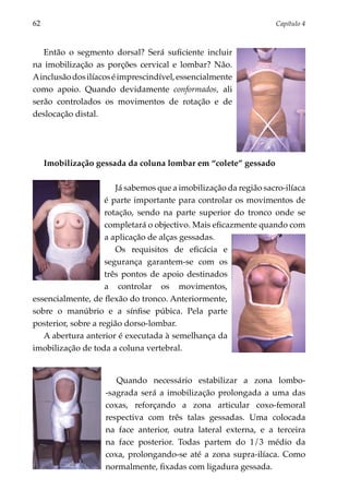 62	                                                                Capítulo 4



   Então o segmento dorsal? Será suficiente incluir
na imobilização as porções cervical e lombar? Não.
A inclusão dos ilíacos é imprescindível, essencialmente
como apoio. Quando devidamente conformados, ali
serão controlados os movimentos de rotação e de
deslocação distal.




      Imobilização gessada da coluna lombar em “colete” gessado

                        Já sabemos que a imobilização da região sacro-ilíaca
                     é parte importante para controlar os movimentos de
                     rotação, sendo na parte superior do tronco onde se
                     completará o objectivo. Mais eficazmente quando com
                     a aplicação de alças gessadas.
                        Os requisitos de eficácia e
                     segurança garantem-se com os
                     três pontos de apoio destinados
                     a controlar os movimentos,
essencialmente, de flexão do tronco. Anteriormente,
sobre o manúbrio e a sínfise púbica. Pela parte
posterior, sobre a região dorso-lombar.
   A abertura anterior é executada à semelhança da
imobilização de toda a coluna vertebral.


                        Quando necessário estabilizar a zona lombo-
                     -sagrada será a imobilização prolongada a uma das
                     coxas, reforçando a zona articular coxo-femoral
                     respectiva com três talas gessadas. Uma colocada
                     na face anterior, outra lateral externa, e a terceira
                     na face posterior. Todas partem do 1/3 médio da
                     coxa, prolongando-se até a zona supra-ilíaca. Como
                     normalmente, fixadas com ligadura gessada.
 