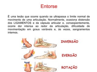 Entorse
É uma lesão que ocorre quando se ultrapassa o limite normal de
movimento de uma articulação. Normalmente, ocasiona distensão
dos LIGAMENTOS e da cápsula articular e, conseqüentemente,
ocorre dor intensa ao redor da articulação, dificuldade de
movimentação em graus variáveis e, às vezes, sangramentos
internos.
 