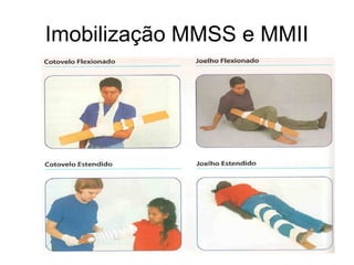 Imobilização MMSS e MMII
 
