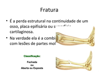 Fratura
 É a perda estrutural na continuidade de um osso, placa
epifisária ou superfície cartilaginosa.
 Na verdade ela é a combinação da lesão óssea com lesões de
partes moles adjacentes.
Classificação:Classificação:
FechadaFechada
ouou
Aberta ou ExpostaAberta ou Exposta
 