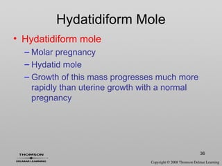 36
Hydatidiform Mole
• Hydatidiform mole
– Molar pregnancy
– Hydatid mole
– Growth of this mass progresses much more
rapidly than uterine growth with a normal
pregnancy
 