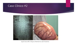 Caso Clínico #2
Ayala-Garcia MA, Tofoya D, Martinez KI, Giant Fecaloma
 