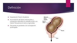 Definición
 Impactación Fecal o fecaloma
 Acumulación de heces endurecidas y
compactas retenidas en ampolla rectal, con
menor frecuencia en recto y sigmoides.
 Frecuente en pacientes con constipación
prolongada
 