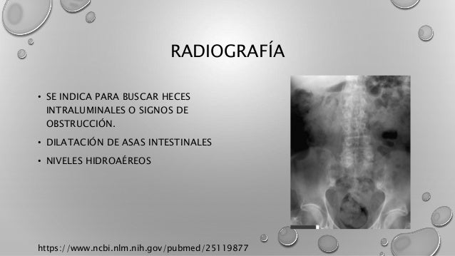 Impactacion fecal