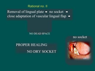 Rational no. IIRational no. II
Removal of lingual plate no socket
close adaptation of vascular lingual flap
NO DEAD SPACE
...