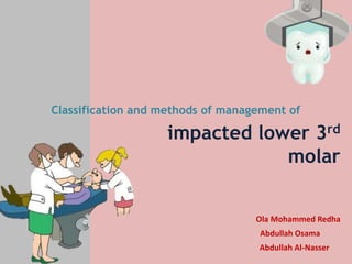impacted lower 3rd
molar
Classification and methods of management of
Ola Mohammed Redha
Abdullah Osama
Abdullah Al-Nasser
 