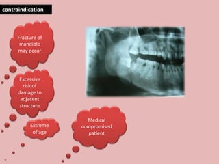 Extreme
of age
Medical
compromised
patient
Excessive
risk of
damage to
adjacent
structure
Fracture of
mandible
may occur
contraindication
 