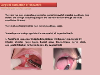 Surgical extraction of impacted
mandibular third molar
Several common steps apply to the removal of all impacted teeth
1. Anesthesia in cases of impacted mandibular third molars is achieved by:
inferior alveolar nerve block, buccal nerve block , lingual nerve block,
and local infiltration for hemostasis in the surgical field
There are two main intraoral approaches for surgical removal of impacted mandibular third
molars: one through the sublingual space and the other buccally through the entire
mandibular thickness.
There is also extraoral method from the submandibular space.
 
