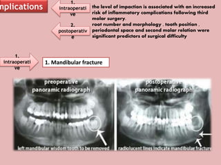 mplications
1.
intraoperati
ve
2.
postoperativ
e
the level of impaction is associated with an increased
risk of inflammatory complications following third
molar surgery.
root number and morphology , tooth position ,
periodontal space and second molar relation were
significant predictors of surgical difficulty
1.
intraoperati
ve
1. Mandibular fracture
 