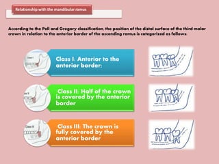 Relationship with the mandibular ramus
According to the Pell and Gregory classification, the position of the distal surface of the third molar
crown in relation to the anterior border of the ascending ramus is categorized as follows:
Class I: Anterior to the
anterior border;
Class II: Half of the crown
is covered by the anterior
border
Class III: The crown is
fully covered by the
anterior border
 